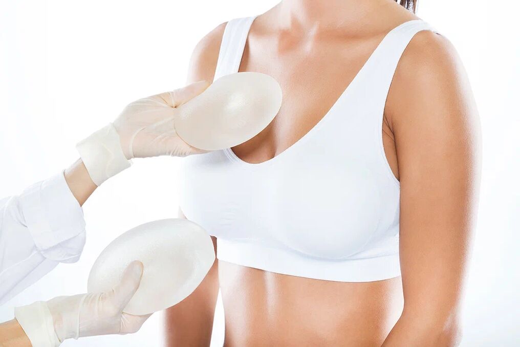 Seleção de implantes antes da cirurgia de aumento de mama