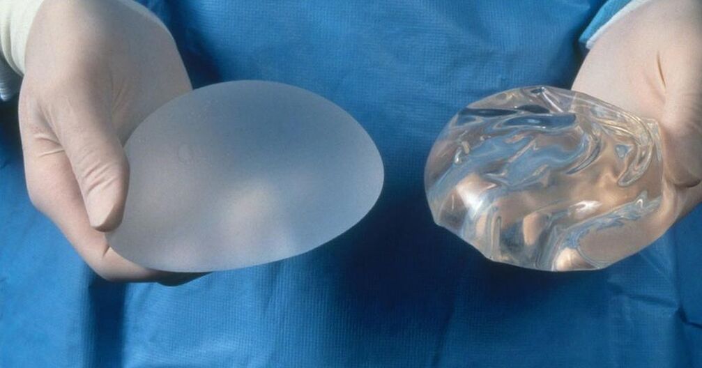 implantar