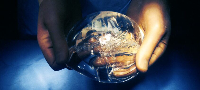 Endoprótese de silicone